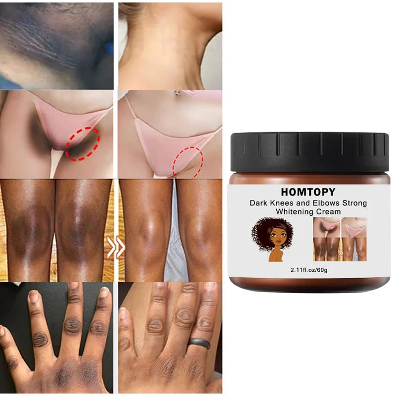 Body Whitening Cream Dark Skin Intimate Areas Brightening Cream Lasting Moisturizing Smooth Soft Body Skin Care Product